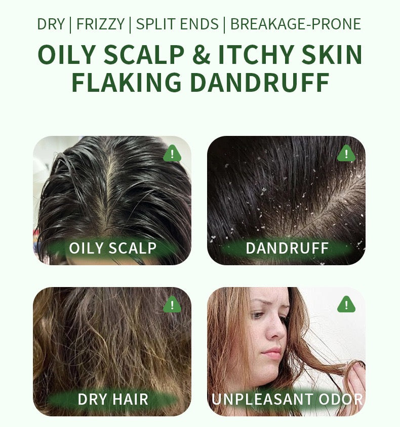 Xinjiang Usman Grass & He Shou Wu Hair Darkening Shampoo Bar (120g) | Anti-Hair Loss, Oil Control & Dandruff Treatment | Natural Herbal Solid Soap for Hair Growth